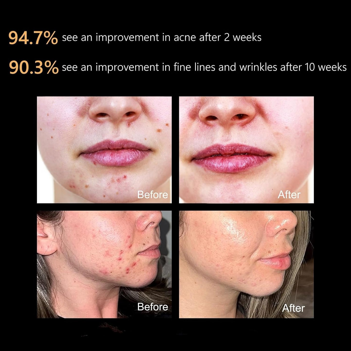 LED Facial Skin Care Mask