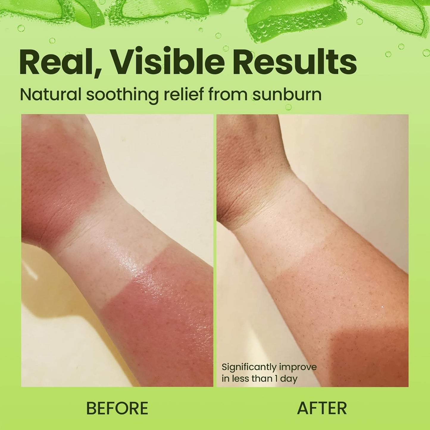 Honeyskin Soothing Aloe Vera Gel